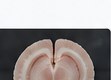 ANOK brain matrix application brain slicing research